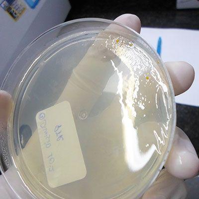 Teste de micro bacteriana